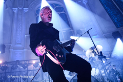 Triggerfinger
