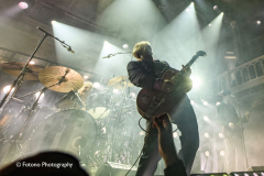 Triggerfinger
