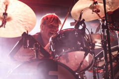 Triggerfinger