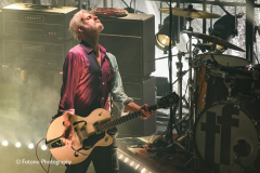 Triggerfinger