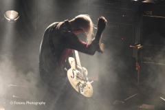 Triggerfinger